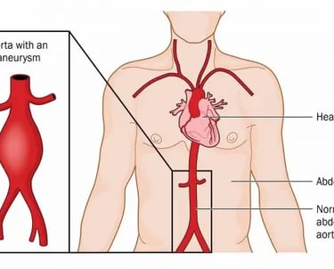 Aorta