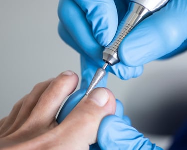 quiropodia, uña encarnada, corte uña, callos illescas