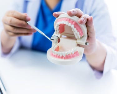 زراعة الأسنان - عيادة طب الاسنان دكتور وسام علي العباسي