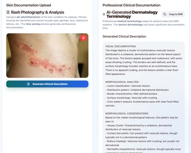Sample output from dermdescribe app interpreting a shingles rash