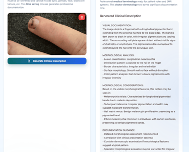 Sample output of derm describe app describing a lesion on a fingernail