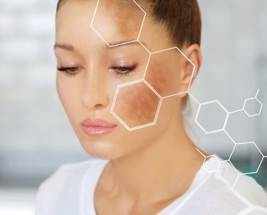 woman with dark spots on her face