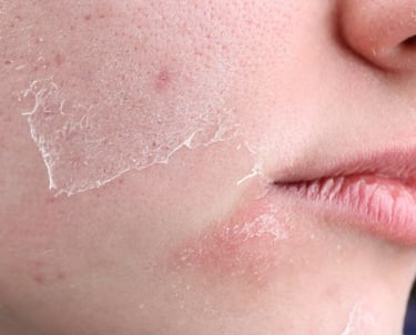 woman with dry skin