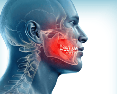 Cráneo humano con la mandíbula y los dientes resaltados en rojo, indicando dolor mandibular