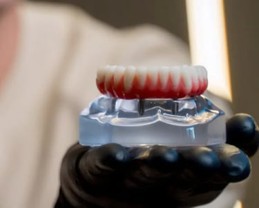 Tratamentos com implante dentário e seus benefícios