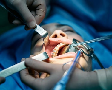 Cirugía en el dentista