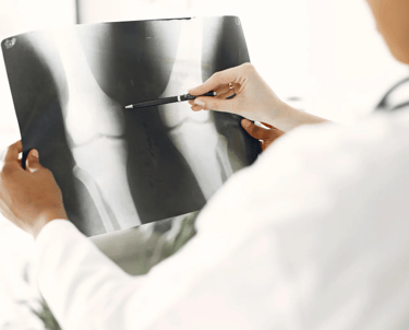 Doctor looking at x-rays