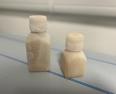 Bulk Autoimmune human Serum and plasma