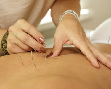 agulhas de acupuntura nas costas