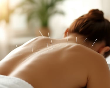 agulhas de acupuntura nas costas