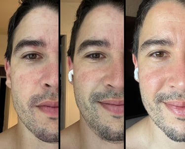 Skin résultats en 5 jours