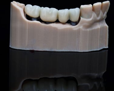 Dental Bridge