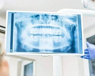 X-Ray of whole mouth front view