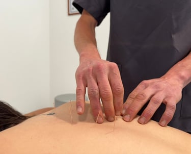 Aurelio_aplicando_tratamiento_de_acupuntura