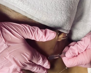 derma plane facial by mallory at vanity esthetics located at Meraki and co salon and spa 