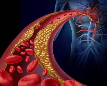 a blood clotsh and blood vessels in a vein