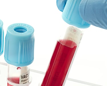 consultoría de acreditación ENAC y metrología - Consultores ISO en Marca Blanca