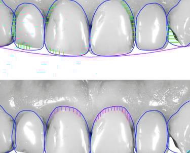 Digital smile design (DSD)