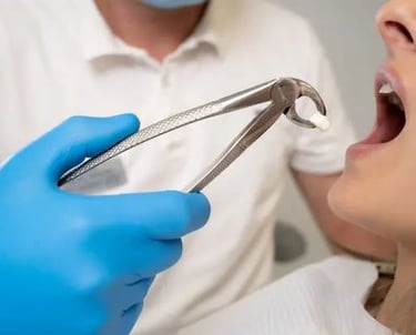 Tooth extraction Greenville SC