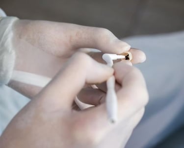 dental crown greenville SC