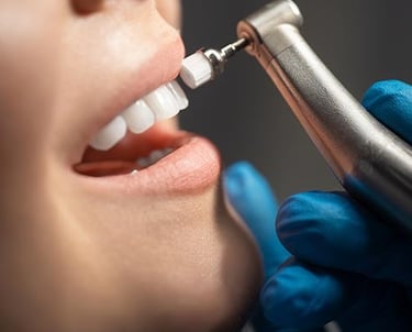 Cosmetic dentistry teeth cleaning greenville sc