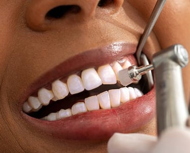 new teeth greenville SC
