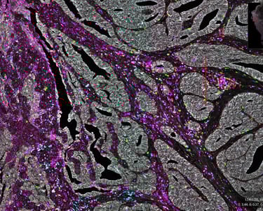 A multiplex immunoflourescence image from the paper that this image links to