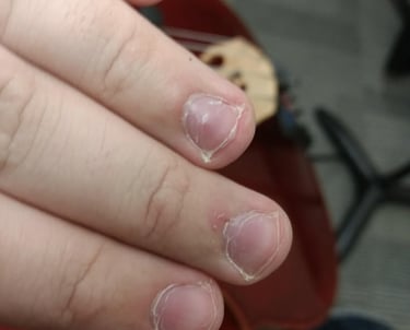 roer unhas
