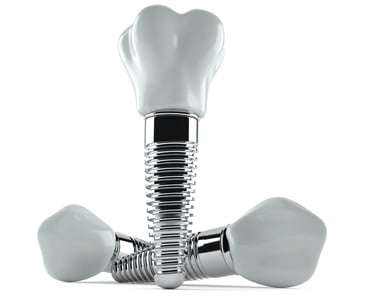 İmplant ve implant üstü protezler