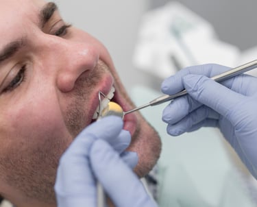 Dentista-Gambara-otturazione