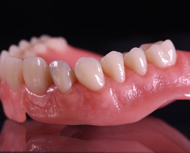 PROTESI-MOBILE-dentiera-dott-vivaldini