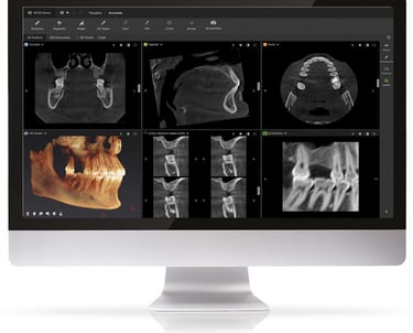 Tac Cone Bean progettazione di un caso clinico