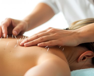 a woman getting acupied with acupress needles