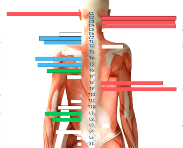 Before Insight neurological scan at Three Nails Chiropractic Franklin TN