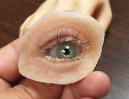 Protesis oculopalpebral protesis en silicona hiperrealistas