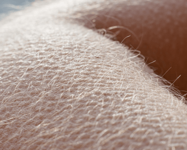 a close up of a person's arm and arm