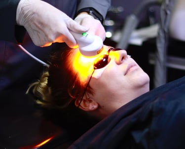 laser terapia de baixa intensidade no protocolo de remoção de pigmentos em sobrancelhas