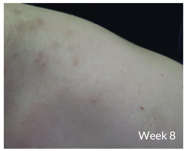 skin 3