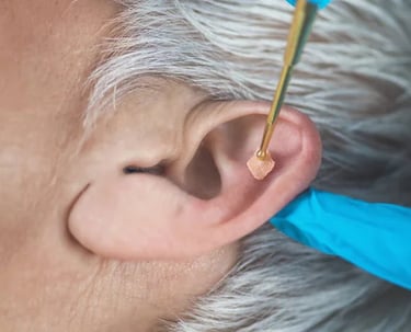La réflexologie auriculaire