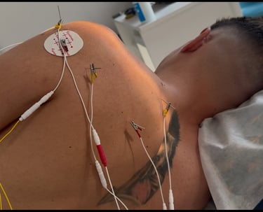 Neuromodelação funcional