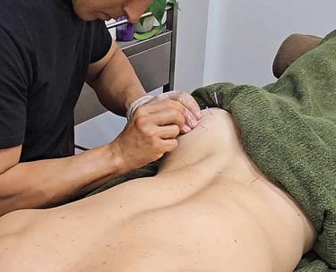 Wollongong Therapist putting needles into a buttock as part of dry needling massage