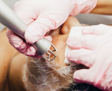 pico laser fractional laser ablative laser for acne scars
