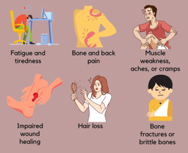 vitamin d symptoms