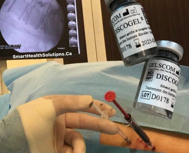 Discogel injection , Discogel vial