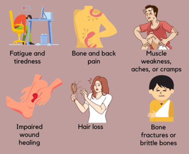 vitamin d symptoms