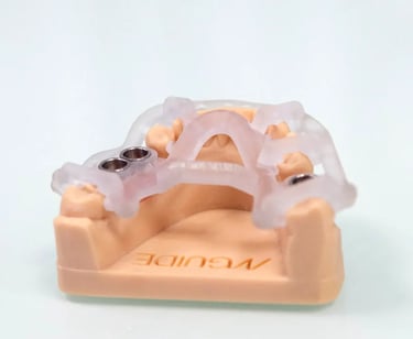 Implantes dentales con cirugía guiada en Sevilla