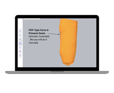 BenX patient-focused prosthetic design software