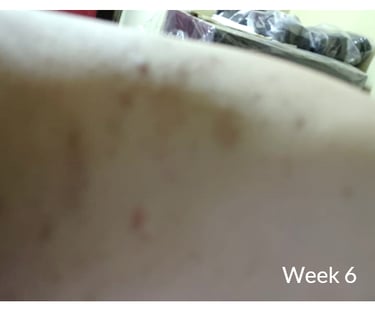 skin 2