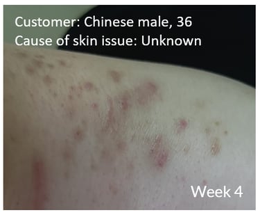 skin1