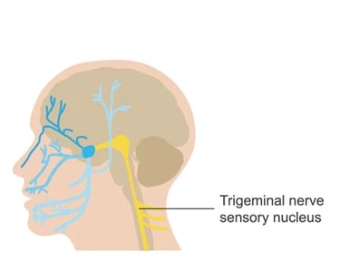 headache from neck pain